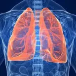 La Bronchite: Cause e cura